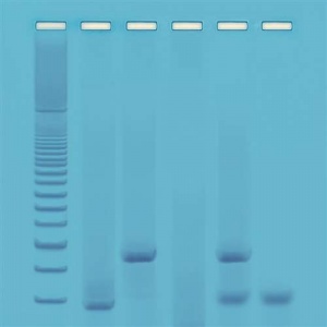 DNA Fingerprinting - Using PCR