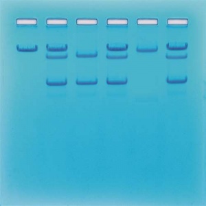 Sickle Cell Gene Detection Kit