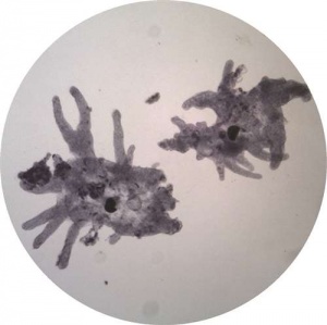 Protozoa - Live - Amoeba Proteus