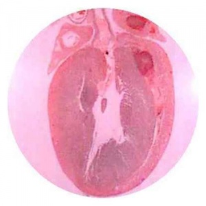 Entire Heart, LS Small Mammal, showing Chambers & Valves - Slide