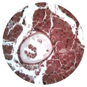 Striated Muscle, TS showing Muscle Spindles - Slide