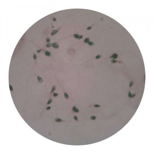 Human Spermatozoa Smear - Slide