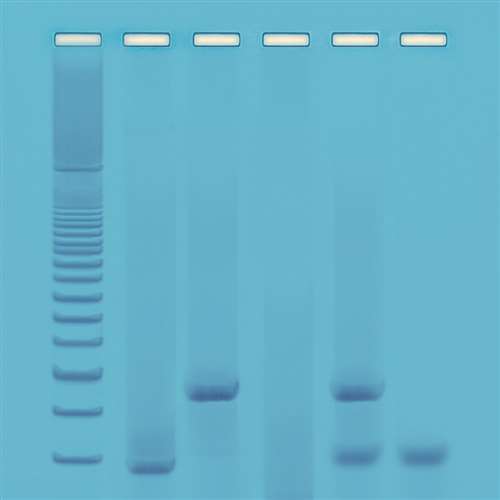 DNA Fingerprinting - Using PCR