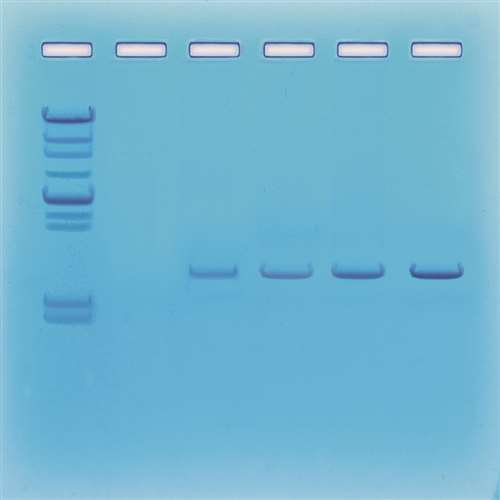DNA Fingerprinting - Using Enzymes